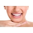 Tiras de clareamento dental SMILY WHITE Consumíveis e acessórios
